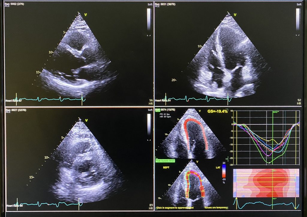 What Is a Cardiac Imaging Test? A Complete Guide
