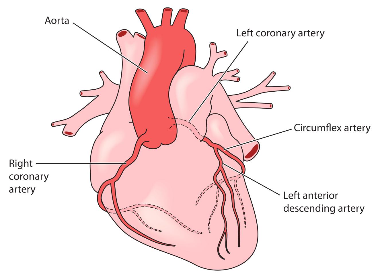 Understanding How Percutaneous Coronary Intervention Works
