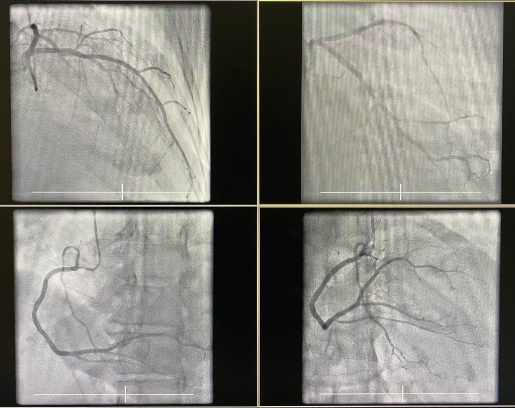 Who Performs Percutaneous Coronary Intervention?